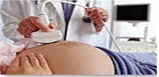 Ultrasound for pregnancy PC screenshot